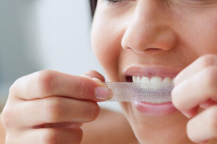 How to Whiten Teeth Naturally at Home Safely in 2026