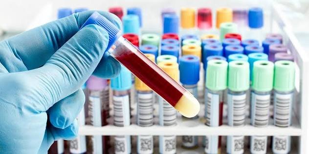 Blood Test Results Explained: A Simple Guide for Beginners
